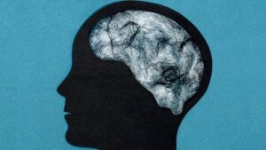 Scientists Find That ‘Brain Fog’ Of Long Covid Equivalent To Ageing 10 Years