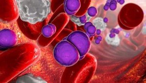 Sepsis failings still causing too many deaths – ombudsman