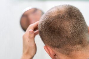 Your Hair Is Your Crown: Check How Aloe Vera Strengthens Oily Hair And Improves Its Health