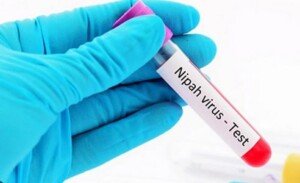 One dies of Nipah virus in Manikganj
