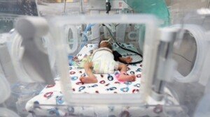 One in 10 premature births linked to plastic chemicals: study