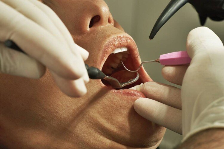 National Dentist Day 2024: Dispelling dental care myths