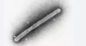 US reports 2nd human case of bird flu tied to dairy cow outbreak