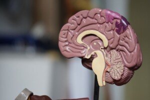 Study gives more insight into neuroblastoma treatment