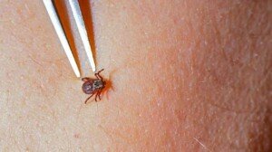 Lyme disease is becoming more common. But its symptoms aren’t always easy to spot
