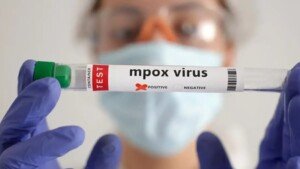 WHO flags limited mpox testing in epicentre DRC