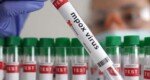 Germany identifies its first case of new mpox variant