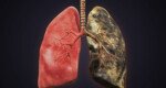 Breathing with Purpose: Lung cancer awareness for a healthier future