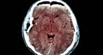 A New System Aims to Save Injured Brains and Lives