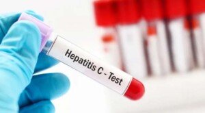 GP patients to help NHS find more infected blood victims