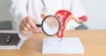 Indonesia to push DNA screening for cervical cancer nationwide