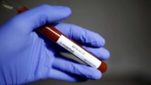 DGHS reduces COVID test fees