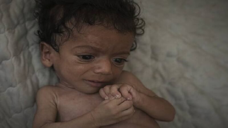 UK to take in hundreds of children from Gaza for medical treatment