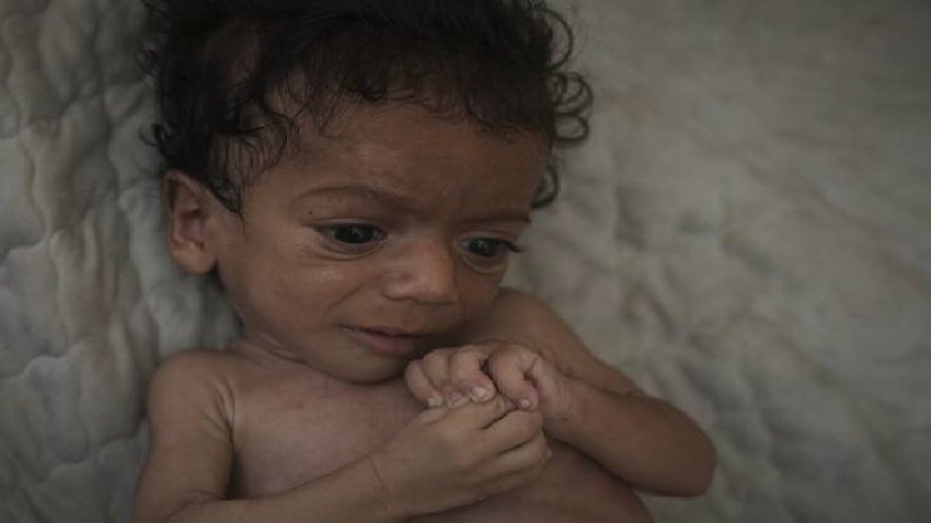 UK to take in hundreds of children from Gaza for medical treatment