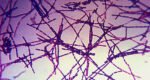 Govt steps up emergency measures to contain anthrax outbreak in cattle