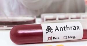 9 more Anthrax cases detected in Rangpur