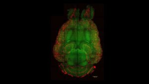 Breakthrough nanotechnology could help reverse Alzheimer’s damage