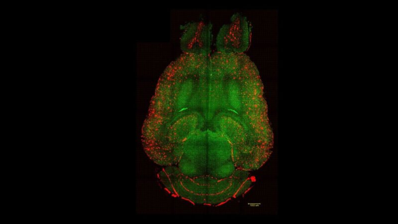 Breakthrough nanotechnology could help reverse Alzheimer’s damage