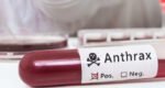 From livestock to humans: why Anthrax remains a global concern