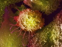 Expert panel advises against prostate cancer screening for most men in UK