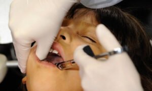 Countries agree to end mercury tooth fillings by 2034