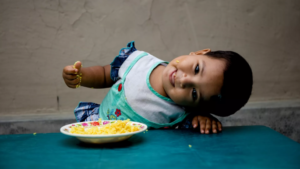 Child nutrition stagnates amid persistent wasting, low dietary diversity: Survey