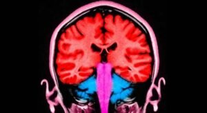 Can a pulse of electricity to the brain make us less selfish?