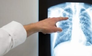 Malaysia warns of TB risk in crowded ramadan bazaars