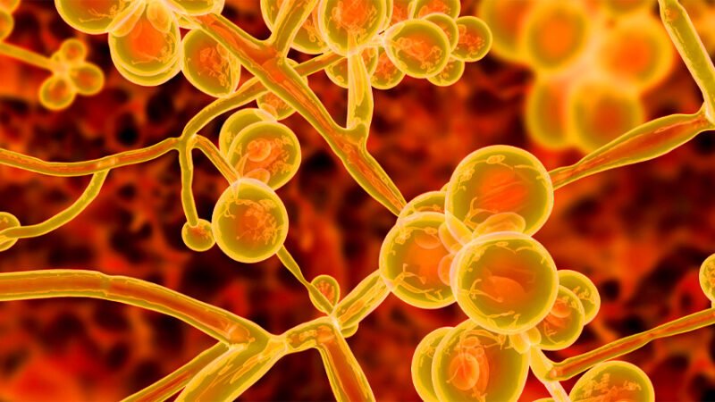 ‘Drug resistant fungal ‘superbug’ spreads in Dhaka ICU’s’