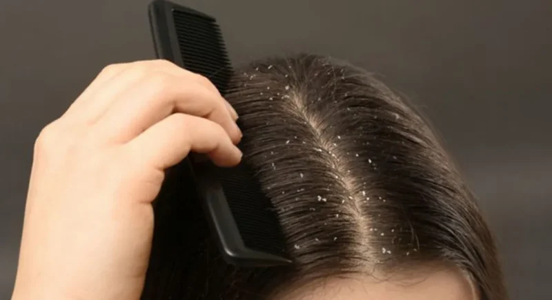 Five fruits to keep hair healthy and strong