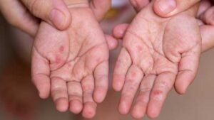 Govt moves to contain situation, takes necessary measures