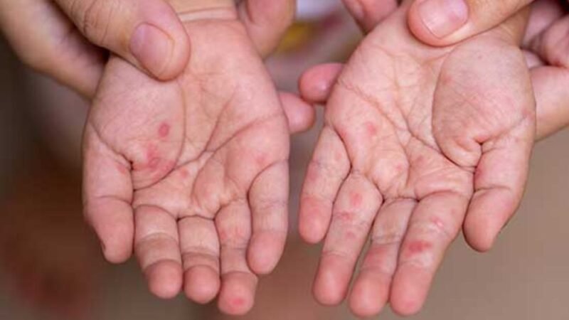 Govt moves to contain situation, takes necessary measures