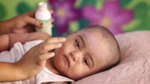 2 more children die with measles-like symptoms in Sylhet; death toll rises to 76
