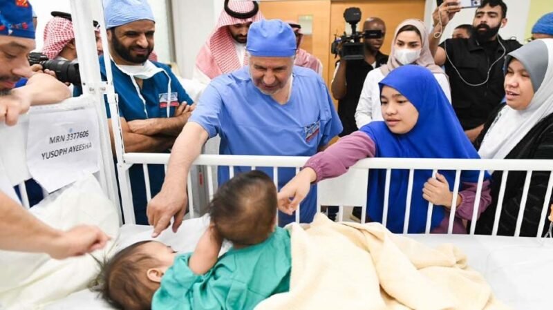 Filipino conjoined twins separated after 6-hour surgery in Riyadh