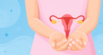 Expert advice on detecting and managing PCOS in young women