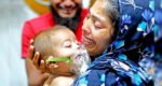 4 more die as measles toll reaches 652