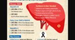 Bangladesh’s liver disease pattern shifts as fatty liver cases rise