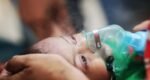 2 more children with measles symptoms die in Sylhet