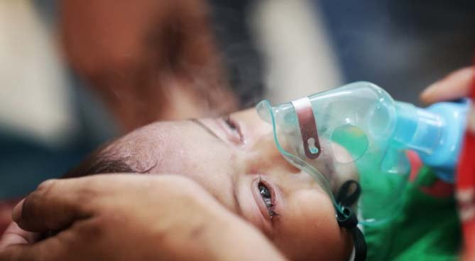 2 more children with measles symptoms die in Sylhet
