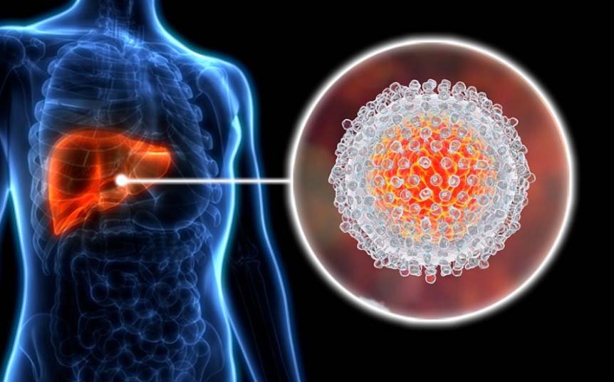 WHO: Bangladesh among top 10 countries for hepatitis C burden