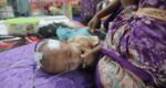 3 children die in one day due to measles symptoms in Sylhet