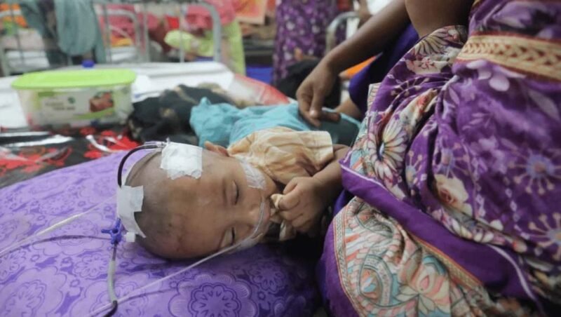 3 children die in one day due to measles symptoms in Sylhet