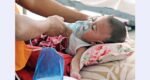 Child deaths from measles, symptoms hit 950