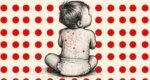 4 children die of measles symptoms in Sylhet in single day