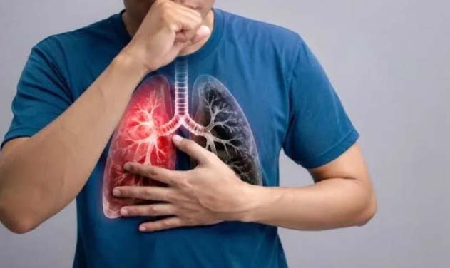 World Lung Day : Lung diseases kill 3.4m globally